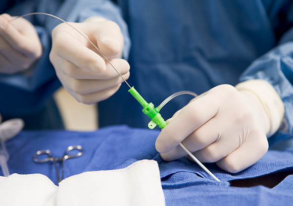 Cardiovascular surgeon inserting angioplasty tube into a patient